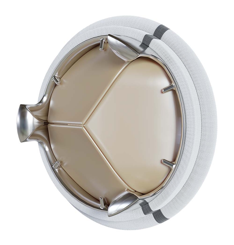 Valve aortique artificielle