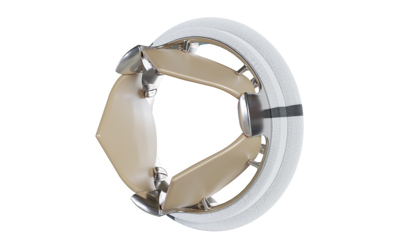 Valve aortique implantable TRIFLO