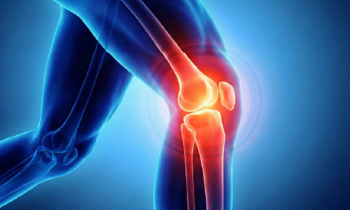 Contract manufacturing